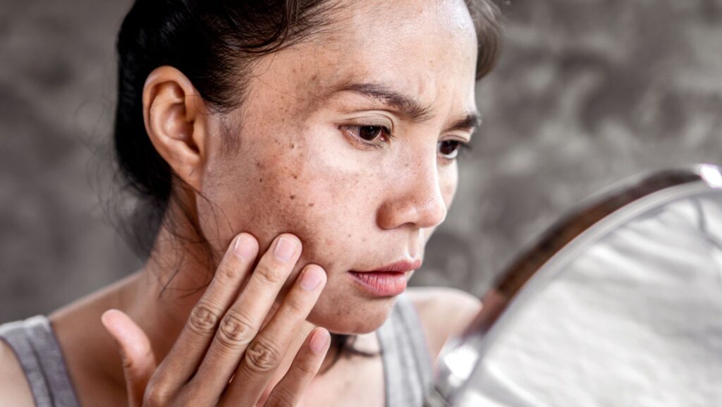 los mejores dispositivos para combatir las manchas